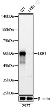 Western blot analysis of lysates from wild type(WT) and LKB1 knockout (KO) 293T cells, using [KO Validated] LKB1 Rabbit mAb (A22636) at 1:7000 dilution.|Secondary antibody: HRP-conjugated Goat anti-Rabbit IgG (H+L) (AS014) at 1:10000 dilution.|Lysates/proteins: 25μg per lane.|Blocking buffer: 3% nonfat dry milk in TBST.|Detection: ECL Basic Kit (RM00020).|Exposure time: 60s.