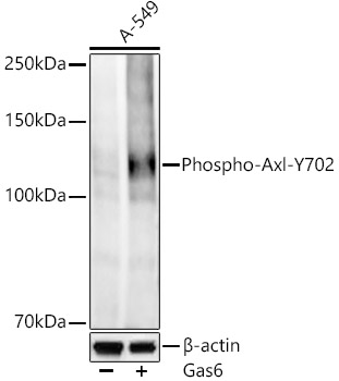 Western blot analysis of lysates from wild type (WT) and A-549 cells transfected with Gas6 using Phospho-Axl-Y702 Rabbit mAb at 1:500 dilution.|Secondary antibody: HRP-conjugated Goat anti-Rabbit IgG (H+L) at 1:10000 dilution.|Lysates/proteins: 25μg per lane.|Blocking buffer: 3% nonfat dry milk in TBST.|Detection: ECL Enhanced Kit.|Exposure time: 180s.