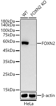 Western blot analysis of extracts from  wild type (WT) and FOXN2 knockout (KO) HeLa(KO) cells, using [KO Validated] FOXN2 Rabbit mAb (A22637) at 1:1000 dilution.|Secondary antibody: HRP-conjugated Goat anti-Rabbit IgG (H+L) (AS014) at 1:10000 dilution.|Lysates/proteins: 25μg per lane.|Blocking buffer: 3% nonfat dry milk in TBST.|Detection: ECL Basic Kit (RM00020).|Exposure time: 10s.