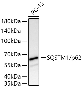 Western blot analysis of lysates from PC-12 cells using SQSTM1/p62 Rabbit mAb at 1:4000 dilution incubated overnight at 4℃.|Secondary antibody: HRP-conjugated Goat anti-Rabbit IgG (H+L) at 1:10000 dilution.|Lysates/proteins: 25 μg per lane.|Blocking buffer: 3% nonfat dry milk in TBST.|Detection: ECL Basic Kit.|Exposure time: 45 s.