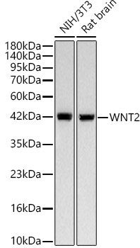 Western blot analysis of various lysates, using WNT2 Rabbit mAb (A23997) at 1:3000 dilution.|Secondary antibody: HRP-conjugated Goat anti-Rabbit IgG (H+L) (AS014) at 1:10000 dilution.|Lysates/proteins: 25μg per lane.|Blocking buffer: 3% nonfat dry milk in TBST.|Detection: ECL Basic Kit (RM00020).|Exposure time: 10s.