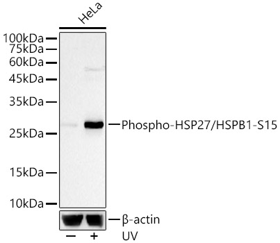 Western blot analysis of lysates from HeLa cells, using Phospho-HSP27/HSPB1-S15 Rabbit mAb at 1:2000 dilution. HeLa cells were treated with UV at room temperature for 15-30 minutes.|Secondary antibody: HRP-conjugated Goat anti-Rabbit IgG (H+L) at 1:10000 dilution.|Lysates/proteins: 25μg per lane.|Blocking buffer: 3% nonfat dry milk in TBST.|Detection: ECL Basic Kit.|Exposure time: 10s.
