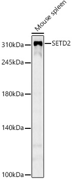 Western blot analysis of lysates from Mouse spleen, using SETD2 Rabbit mAb at 1:1000 dilution.Secondary antibody: HRP-conjugated Goat anti-Rabbit IgG (H+L) at 1:10000 dilution.Lysates/proteins: 25μg per lane.Blocking buffer: 3% nonfat dry milk in TBST.Detection: ECL Basic Kit.Exposure time: 60s.