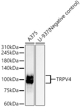 Western blot analysis of various lysates, using TRPV4 Rabbit mAb (A22657) at 1:5000 dilution.|Secondary antibody: HRP-conjugated Goat anti-Rabbit IgG (H+L) (AS014) at 1:10000 dilution.|Lysates/proteins: 25μg per lane.|Blocking buffer: 3% nonfat dry milk in TBST.|Detection: ECL Basic Kit (RM00020).|Exposure time: 3s.