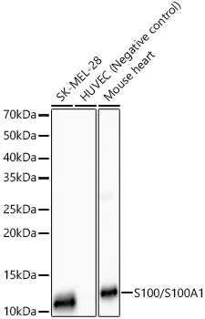 Western blot analysis of various lysates, using S100/S100A1 Rabbit mAb at 1:10000 dilution.|Secondary antibody: HRP-conjugated Goat anti-Rabbit IgG (H+L) at 1:10000 dilution.|Lysates/proteins: 25μg per lane.|Blocking buffer: 3% nonfat dry milk in TBST.|Detection: ECL Basic Kit.|Exposure time: 90s.
