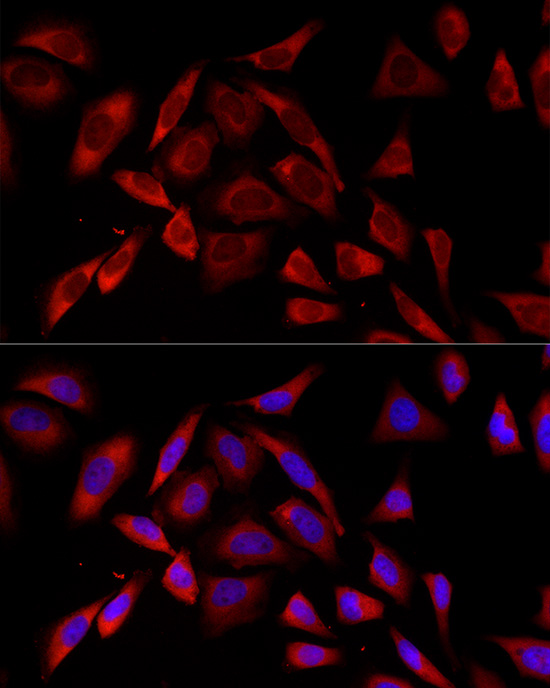 Immunofluorescence analysis of HeLa cells using PKC alpha Rabbit mAb at dilution of 1:100 (40x lens). Secondary antibody: Cy3-conjugated Goat anti-Rabbit IgG (H+L) at 1:500 dilution. Blue: DAPI for nuclear staining.
