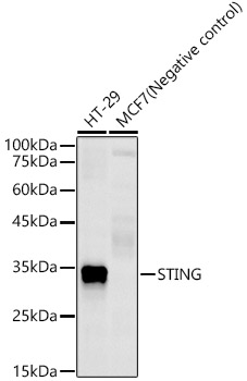 Western blot analysis of various lysates, using STING Rabbit mAb at 1:2000 dilution.|Secondary antibody: HRP-conjugated Goat anti-Rabbit IgG (H+L) at 1:10000 dilution.|Lysates/proteins: 25μg per lane.|Blocking buffer: 3% nonfat dry milk in TBST.|Detection: ECL Enhanced Kit.|Exposure time: 180s.