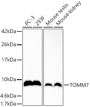 Western blot analysis of various lysates, using TOMM7 Rabbit mAb (A22713) at  1:1000 dilution.|Secondary antibody: HRP-conjugated Goat anti-Rabbit IgG (H+L) (AS014) at 1:10000 dilution.|Lysates/proteins: 25μg per lane.|Blocking buffer: 3% nonfat dry milk in TBST.|Detection: ECL Basic Kit (RM00020).|Exposure time: 180s.