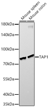 Western blot analysis of various lysates, using TAP1 Rabbit mAb at  1:10000 dilution.|Secondary antibody: HRP-conjugated Goat anti-Rabbit IgG (H+L) at 1:10000 dilution.|Lysates/proteins: 25μg per lane.|Blocking buffer: 3% nonfat dry milk in TBST.|Detection: ECL Enhanced Kit.|Exposure time: 90s.