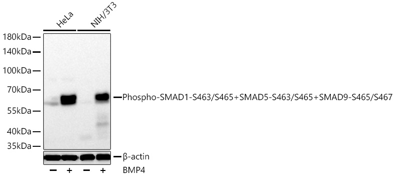 Western blot analysis of various lysates using Phospho-SMAD1-S463/S465+SMAD5-S463/S465+SMAD9-S465/S467 Rabbit mAb at 1:1000 dilution incubated overnight at 4℃. HeLa cells and NIH/3T3 cells were treated with BMP4 (50 ng/mL) at 37℃ for 30 minutes.|Secondary antibody: HRP-conjugated Goat anti-Rabbit IgG (H+L) at 1:10000 dilution.|Lysates/proteins: 30 μg per lane.|Blocking buffer: 3% nonfat dry milk in TBST.|Detection: ECL Basic Kit.|Exposure time: 30s.
