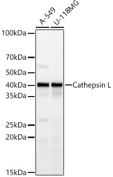 Western blot analysis of various lysates, using Cathepsin L Rabbit mAb at 1:1000 dilution.|Secondary antibody: HRP-conjugated Goat anti-Rabbit IgG (H+L) at 1:10000 dilution.|Lysates/proteins: 25μg per lane.|Blocking buffer: 3% nonfat dry milk in TBST.|Detection: ECL Basic Kit.|Exposure time: 10s.