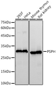 Western blot analysis of various lysates, using PSPH Rabbit mAb at  1:10000 dilution.|Secondary antibody: HRP-conjugated Goat anti-Rabbit IgG (H+L) at 1:10000 dilution.|Lysates/proteins: 25μg per lane.|Blocking buffer: 3% nonfat dry milk in TBST.|Detection: ECL Basic Kit.|Exposure time: 90s.