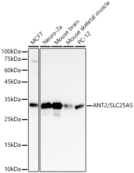 Western blot analysis of various lysates, using ANT2/SLC25A5 Rabbit mAb at 1:2000 dilution.|Secondary antibody: HRP-conjugated Goat anti-Rabbit IgG (H+L) at 1:10000 dilution.|Lysates/proteins: 25μg per lane.|Blocking buffer: 3% nonfat dry milk in TBST.|Detection: ECL Basic Kit.|Exposure time: 1s.