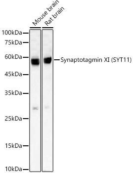 Western blot analysis of various lysates, using Synaptotagmin XI (SYT11) Rabbit mAb at  1:2000 dilution.|Secondary antibody: HRP-conjugated Goat anti-Rabbit IgG (H+L) at 1:10000 dilution.|Lysates/proteins: 25μg per lane.|Blocking buffer: 3% nonfat dry milk in TBST.|Detection: ECL Basic Kit.|Exposure time: 30s.