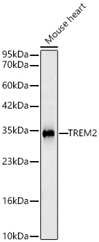 Western blot analysis of lysates from Mouse heart using TREM2 Rabbit mAb (A23432) at 1:1000 dilution incubated overnight at 4℃.|Secondary antibody: HRP-conjugated Goat anti-Rabbit IgG (H+L) (AS014) at 1:10000 dilution.|Lysates/proteins: 25 μg per lane.|Blocking buffer: 3% nonfat dry milk in TBST.|Detection: ECL Basic Kit (RM00020).|Exposure time: 60s.