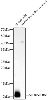 Western blot analysis of various lysates, using S100/S100A1 Rabbit mAb at 1:1000 dilution.|Secondary antibody: HRP-conjugated Goat anti-Rabbit IgG (H+L) at 1:10000 dilution.|Lysates/proteins: 25μg per lane.|Blocking buffer: 3% nonfat dry milk in TBST.|Detection: ECL Basic Kit.|Exposure time: 10s.