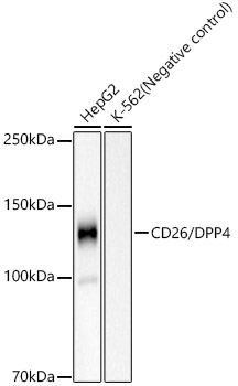 Western blot analysis of various lysates, using CD26/DPP4 Rabbit mAb at 1:1500 dilution.|Secondary antibody: HRP-conjugated Goat anti-Rabbit IgG (H+L) at 1:10000 dilution.|Lysates/proteins: 25μg per lane.|Blocking buffer: 3% nonfat dry milk in TBST.|Detection: ECL Basic Kit.|Exposure time: 60s.