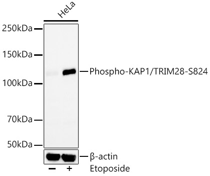 Western blot analysis of lysates from HeLa cells, using Phospho-KAP1/TRIM28-S824 Rabbit mAb at  1:5000 dilution. HeLa cells were treated with Etoposide (25 uM) at 37℃ for 5 hours.|Secondary antibody: HRP-conjugated Goat anti-Rabbit IgG (H+L) at 1:10000 dilution.|Lysates/proteins: 25μg per lane.|Blocking buffer: 3% nonfat dry milk in TBST.|Detection: ECL Enhanced Kit.|Exposure time: 60s.