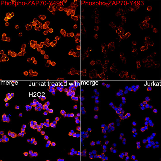 Immunofluorescence analysis of Jurkat treated with H2O2 and Jurkat cells using Phospho-ZAP70-Y493 Rabbit mAb at dilution of 1:100 (40x lens). Secondary antibody: Cy3-conjugated Goat anti-Rabbit IgG (H+L) at 1:500 dilution. Blue: DAPI for nuclear staining.