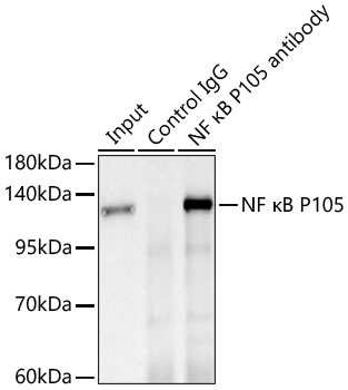 Immunoprecipitation of NF κB P105 from 300 µg extracts of 293T cells was performed using 3 µg of NF κB P105 Rabbit mAb. Rabbit IgG isotype control was used to precipitate the Control IgG sample. IP samples were eluted with 1X Laemmli Buffer. The Input lane represents 10% of the total input. Western blot analysis of immunoprecipitates was conducted using NF κB P105 Rabbit mAb at a dilution of 1 : 2000.