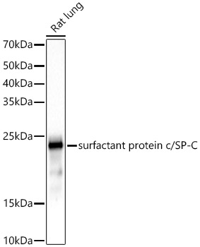 Western blot analysis of lysates from Rat lung, using surfactant protein c/SP-C Rabbit mAb at 1:2000 dilution.|Secondary antibody: HRP-conjugated Goat anti-Rabbit IgG (H+L) at 1:10000 dilution.|Lysates/proteins: 25μg per lane.|Blocking buffer: 3% nonfat dry milk in TBST.|Detection: ECL Basic Kit.|Exposure time: 90s.