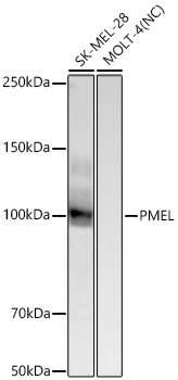 Western blot analysis of various lysates using PMEL Rabbit mAb at 1:1000 dilution incubated overnight at 4℃.|Secondary antibody: HRP-conjugated Goat anti-Rabbit IgG (H+L) at 1:10000 dilution.|Lysates/proteins: 25 μg per lane.|Blocking buffer: 3% nonfat dry milk in TBST.|Detection: ECL Basic Kit.|Negative control (NC): MOLT-4|Exposure time: 90s.