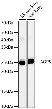 Western blot analysis of various lysates, using AQP5 Rabbit mAb at 1:2000 dilution.|Secondary antibody: HRP-conjugated Goat anti-Rabbit IgG (H+L) at 1:10000 dilution.|Lysates/proteins: 25μg per lane.|Blocking buffer: 3% nonfat dry milk in TBST.|Detection: ECL Basic Kit.|Exposure time: 180s.