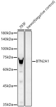 Western blot analysis of various lysates, using BTN2A1 Rabbit mAb at 1:2000 dilution.|Secondary antibody: HRP-conjugated Goat anti-Rabbit IgG (H+L) at 1:10000 dilution.|Lysates/proteins: 25μg per lane.|Blocking buffer: 3% nonfat dry milk in TBST.|Detection: ECL Basic Kit.|Exposure time: 30s.
