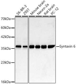Western blot analysis of various lysates using Syntaxin 6 Rabbit mAb at 1:2000 dilution incubated overnight at 4℃.|Secondary antibody: HRP-conjugated Goat anti-Rabbit IgG (H+L) at 1:10000 dilution.|Lysates/proteins: 25 μg per lane.|Blocking buffer: 3% nonfat dry milk in TBST.|Detection: ECL Basic Kit.|Exposure time: 60 s.