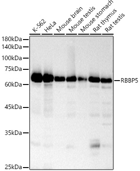 Western blot analysis of various lysates, using RBBP5 Rabbit mAb at 1:2000 dilution.|Secondary antibody: HRP-conjugated Goat anti-Rabbit IgG (H+L) at 1:10000 dilution.|Lysates/proteins: 25μg per lane.|Blocking buffer: 3% nonfat dry milk in TBST.|Detection: ECL Basic Kit.|Exposure time: 30s.