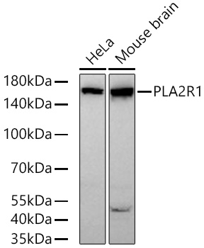 Western blot analysis of various lysates using PLA2R1 Rabbit mAb at 1:1000 dilution incubated overnight at 4℃.|Secondary antibody: HRP-conjugated Goat anti-Rabbit IgG (H+L) at 1:10000 dilution.|Lysates/proteins: 25 μg per lane.|Blocking buffer: 3% nonfat dry milk in TBST.|Detection: ECL Basic Kit.|Exposure time: 30 s.