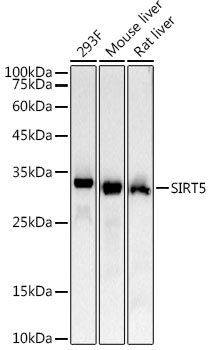Western blot analysis of various lysates, using SIRT5 Rabbit mAb at 1:3000 dilution incubated overnight at 4℃.|Secondary antibody: HRP-conjugated Goat anti-Rabbit IgG (H+L) at 1:10000 dilution.|Lysates/proteins: 25μg per lane.|Blocking buffer: 3% nonfat dry milk in TBST.|Detection: ECL Basic Kit.|Exposure time: 30s.