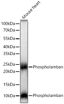 Western blot analysis of lysates from Mouse heart using Phospholamban Rabbit mAb at 1:5000 dilution incubated overnight at 4℃.|Secondary antibody: HRP-conjugated Goat anti-Rabbit IgG (H+L) at 1:10000 dilution.|Lysates/proteins: 25 μg per lane.|Blocking buffer: 3% nonfat dry milk in TBST.|Detection: ECL Basic Kit.|Exposure time: 10 s.