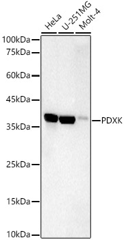 Western blot analysis of various lysates, using PDXK Rabbit mAb at  1:1000 dilution.|Secondary antibody: HRP-conjugated Goat anti-Rabbit IgG (H+L) at 1:10000 dilution.|Lysates/proteins: 25μg per lane.|Blocking buffer: 3% nonfat dry milk in TBST.|Detection: ECL Basic Kit.|Exposure time: 90s.