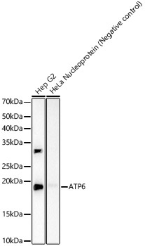 Western blot analysis of various lysates, using ATP6 Rabbit mAb at 1:2000 dilution.|Secondary antibody: HRP-conjugated Goat anti-Rabbit IgG (H+L) at 1:10000 dilution.|Lysates/proteins: 25μg per lane.|Blocking buffer: 3% nonfat dry milk in TBST.|Detection: ECL Basic Kit.|Exposure time: 90s.