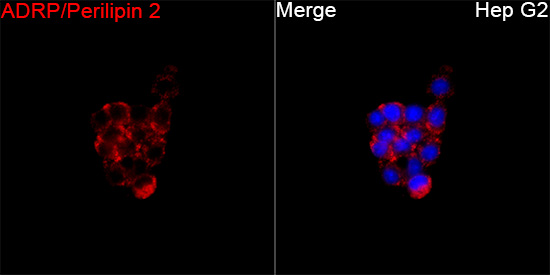Immunofluorescence analysis of Hep G2 cells using ADRP/Perilipin 2 Rabbit mAb at a dilution of 1:100 (40x lens). Secondary antibody: Cy3-conjugated Goat anti-Rabbit IgG (H+L) at 1:500 dilution. Blue: DAPI for nuclear staining.