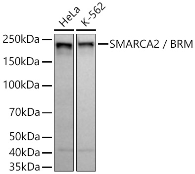 Western blot analysis of various lysates using SMARCA2 / BRM Rabbit mAb at 1:1000 dilution incubated overnight at 4℃.|Secondary antibody: HRP-conjugated Goat anti-Rabbit IgG (H+L) at 1:10000 dilution.|Lysates/proteins: 25 μg per lane.|Blocking buffer: 3% nonfat dry milk in TBST.|Detection: ECL Basic Kit.|Exposure time: 10 s.