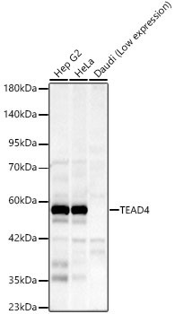 Western blot analysis of various lysates, using TEAD4 Rabbit mAb (A23774) at 1:1000 dilution.|Secondary antibody: HRP-conjugated Goat anti-Rabbit IgG (H+L) (AS014) at 1:10000 dilution.|Lysates/proteins: 25μg per lane.|Blocking buffer: 3% nonfat dry milk in TBST.|Detection: ECL Basic Kit (RM00020).|Exposure time: 60s.