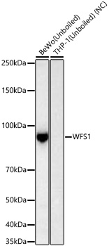 Western blot analysis of various lysates using WFS1 Rabbit mAb (A23244) at 1:5000 dilution incubated at room temperature for 1.5 hours.|Secondary antibody: HRP-conjugated Goat anti-Rabbit IgG (H+L) (AS014) at 1:10000 dilution.|Lysates/proteins: 25 μg per lane.|Blocking buffer: 3% nonfat dry milk in TBST.|Detection: ECL Basic Kit (RM00020).|Negative control (NC): THP-1.|Exposure time: 45 s.