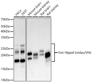Western blot analysis of various lysates, using [KO Validated] Von Hippel Lindau/VHL Rabbit mAb (A23239) at 1:1000 dilution.|Secondary antibody: HRP-conjugated Goat anti-Rabbit IgG (H+L) (AS014) at 1:10000 dilution.|Lysates/proteins: 25μg per lane.|Blocking buffer: 3% nonfat dry milk in TBST.|Detection: ECL Basic Kit (RM00020).|Exposure time: 45s.