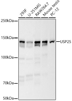 Western blot analysis of various lysates, using USP25 Rabbit mAb (A23431) at 1:5000 dilution.|Secondary antibody: HRP-conjugated Goat anti-Rabbit IgG (H+L) (AS014) at 1:10000 dilution.|Lysates/proteins: 25μg per lane.|Blocking buffer: 3% nonfat dry milk in TBST.|Detection: ECL Basic Kit (RM00020).|Exposure time: 60s.