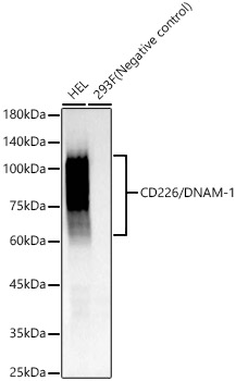 Western blot analysis of various lysates, using CD226/DNAM-1 Rabbit mAb at 1:1000 dilution.|Secondary antibody: HRP-conjugated Goat anti-Rabbit IgG (H+L) at 1:10000 dilution.|Lysates/proteins: 25μg per lane.|Blocking buffer: 3% nonfat dry milk in TBST.|Detection: ECL Basic Kit.|Exposure time: 60s.