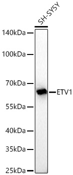 Western blot analysis of lysates from SH-SY5Y cells using [KD Validated] ETV1 Rabbit mAb (A26308) at 1:1000 dilution incubated overnight at 4℃.|Secondary antibody: HRP-conjugated Goat anti-Rabbit IgG (H+L) (AS014) at 1:10000 dilution.|Lysates/proteins: 25 μg per lane.|Blocking buffer: 3% nonfat dry milk in TBST.|Detection: ECL Basic Kit (RM00020).|Exposure time: 45 s.