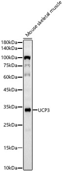 Western blot analysis of lysates from Mouse skeletal muscle, using UCP3 Rabbit mAb (A23285) at 1:1000 dilution.|Secondary antibody: HRP-conjugated Goat anti-Rabbit IgG (H+L) (AS014) at 1:10000 dilution.|Lysates/proteins: 25μg per lane.|Blocking buffer: 3% nonfat dry milk in TBST.|Detection: ECL Basic Kit (RM00020).|Exposure time: 45s.