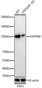 Western blot analysis of lysates from wild type (WT) and HSP90B1 knockdown (KD) HeLa cells using [KD Validated] HSP90B1 Rabbit mAb (A26311) at 1:2000 dilution incubated overnight at 4℃.|Secondary antibody: HRP-conjugated Goat anti-Rabbit IgG (H+L) (AS014) at 1:10000 dilution.|Lysates/proteins: 25 μg per lane.|Blocking buffer: 3% nonfat dry milk in TBST.|Detection: ECL Basic Kit (RM00020).|Exposure time: 20s.