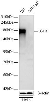 Western blot analysis of lysates from wild type (WT) and EGFR  knockdown (KD) HeLa cells using [KD Validated] EGFR Rabbit mAb at 1:1000 dilution incubated overnight at 4℃.|Secondary antibody: HRP-conjugated Goat anti-Rabbit IgG (H+L) at 1:10000 dilution.|Lysates/proteins: 25 μg per lane.|Blocking buffer: 3% nonfat dry milk in TBST.|Detection: ECL Basic Kit.|Exposure time: 45s.