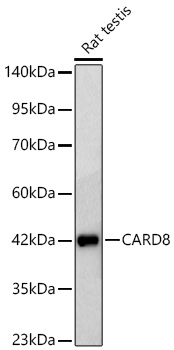 Western blot analysis of lysates from Rat testis using CARD8 Rabbit mAb at 1:3000 dilution incubated overnight at 4℃.|Secondary antibody: HRP-conjugated Goat anti-Rabbit IgG (H+L) at 1:10000 dilution.|Lysates/proteins: 25 μg per lane.|Blocking buffer: 3% nonfat dry milk in TBST.|Detection: ECL Basic Kit.|Exposure time: 20 s.