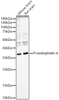 Western blot analysis of various lysates, using Proenkephalin-A Rabbit mAb at 1:1000 dilution.|Secondary antibody: HRP-conjugated Goat anti-Rabbit IgG (H+L) at 1:10000 dilution.|Lysates/proteins: 25μg per lane.|Blocking buffer: 3% nonfat dry milk in TBST.|Detection: ECL Basic Kit.|Exposure time: 90s.