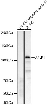 Western blot analysis of various lysates using APLP1 Rabbit mAb at 1:1000 dilution. |Secondary antibody: HRP Goat Anti-Rabbit IgG (H+L) at 1:10000 dilution.|Lysates/proteins: 25 μg per lane.|Blocking buffer: 3% nonfat dry milk in TBST.|Detection: ECL Basic Kit.|Negative control (NC): HL-60 |Exposure time: 60s.