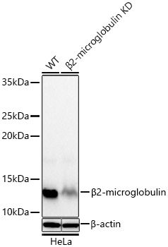 Western blot analysis of lysates from wild type (WT) and β2-microglobulin knockdown (KD) HeLa cells using [KD Validated] beta 2 Microglobulin Rabbit mAb (A27015) at 1:1000 dilution incubated overnight at 4℃.|Secondary antibody: HRP-conjugated Goat anti-Rabbit IgG (H+L) (AS014) at 1:10000 dilution.|Lysates/proteins: 25 μg per lane.|Blocking buffer: 3% nonfat dry milk in TBST.|Detection: ECL Basic Kit (RM00020).|Exposure time: 60s.